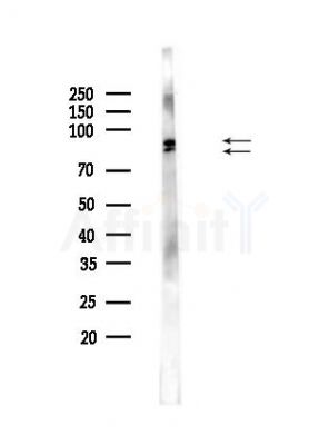 Phospho-RSK2 (Ser227) Antibody - Western blot analysis of lysates from PC12 cells, using Phospho-RSK2 (Ser227) Antibody at 1/1000 dilution.