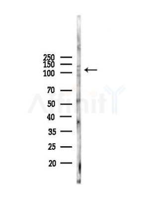 Phospho-Semaphorin 4B (Ser825) Antibody - Western blot analysis of lysates from B16F10-LUC cells(heat-shock,45min treatment), using Phospho-Semaphorin 4B (Ser825) Antibody at 1/1000 dilution.