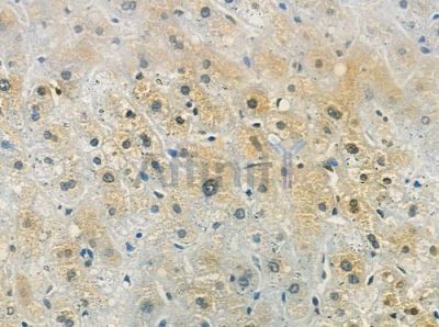 Phospho-INPPL1 (Tyr986/Tyr987) Antibody - AF2405 at 1/100 staining human normal liver tissue by IHC-P.