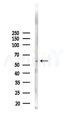 Phospho-TNK1 (Tyr277) Antibody - Western blot analysis of lysates from K562 cells(UV,30min treatment), using Phospho-TNK1 (Tyr277) Antibody at 1/1000 dilution.