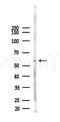 Phospho-TNK1 (Tyr277) Antibody - Western blot analysis of lysates from HUVEC cells(UV,30min treatment), using Phospho-TNK1 (Tyr277) Antibody at 1/1000 dilution.