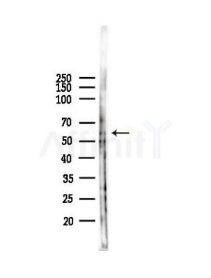 Phospho-Vimentin (Ser83) Antibody - Western blot analysis of lysates from B16F10-LUC cells(heat-shock,45min treatment), using Phospho-Vimentin (Ser83) Antibody at 1/1000 dilution.