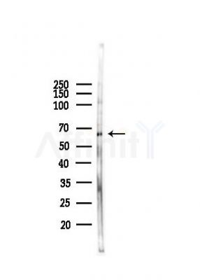 Phospho-KLF4 (Ser254) Antibody - Western blot analysis of lysates from B16F10-LUC cells(heat-shock,45min treatment), using Phospho-KLF4 (Ser254) Antibody at 1/1000 dilution.