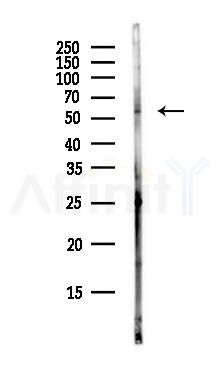 CDC25B Antibody - Western blot analysis of lysates from EC304 cells(heat-shock,45min treatment), using CDC25B Antibody at 1/1000 dilution.