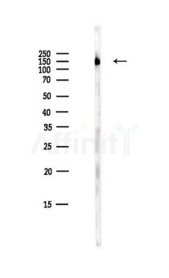 AS160 Antibody - Western blot analysis of lysates from HepG2 cells(LPS,4h treatment), using AS160 Antibody at 1/1000 dilution.