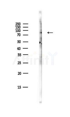 Atg13 Antibody - Western blot analysis of lysates from HepG2 cells(LPS,4h treatment), using Atg13 Antibody at 1/1000 dilution.