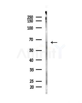 Atg14 Antibody - Western blot analysis of lysates from EC304 cells, using Atg14 Antibody at 1/1000 dilution.