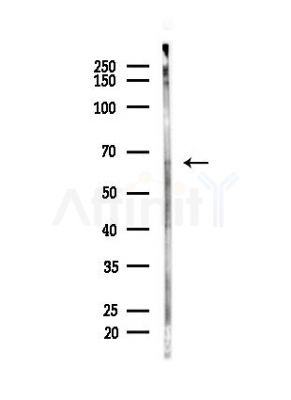 Atg14 Antibody - Western blot analysis of lysates from EC304 cells, using Atg14 Antibody at 1/1000 dilution.