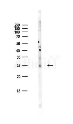 Bim Antibody - Western blot analysis of lysates from HepG2 cells(LPS,4h treatment), using Bim Antibody at 1/1000 dilution.