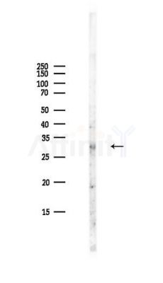 Bim Antibody - Western blot analysis of lysates from PC12 cells(LPS,4h treatment), using Bim Antibody at 1/1000 dilution.