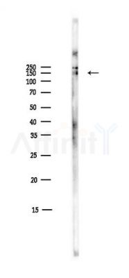c-Kit Antibody - Western blot analysis of lysates from Mouse liver, using c-Kit Antibody at 1/1000 dilution.