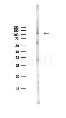 c-Kit Antibody - Western blot analysis of lysates from PC12 cells(LPS,4h treatment), using c-Kit Antibody at 1/1000 dilution.