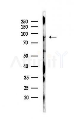 eEF2K Antibody - Western blot analysis of lysates from Mouse brain, using eEF2K Antibody at 1/1000 dilution.
