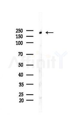 eIF4G1 Antibody - Western blot analysis of lysates from A375 cells(heat-shock,45min treatment), using eIF4G1 Antibody at 1/1000 dilution.