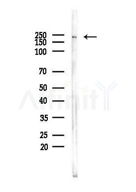 eIF4G1 Antibody - Western blot analysis of lysates from PC12 cells, using eIF4G1 Antibody at 1/1000 dilution.