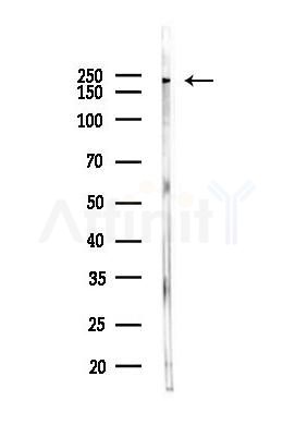 eIF4G1 Antibody - Western blot analysis of lysates from MDA-MB-231 cells, using eIF4G1 Antibody at 1/1000 dilution.