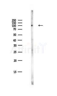 GAB1 Antibody - Western blot analysis of lysates from HepG2 cells(LPS,4h treatment), using GAB1 Antibody at 1/1000 dilution.