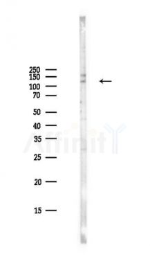 GAB1 Antibody - Western blot analysis of lysates from PC12 cells(LPS,4h treatment), using GAB1 Antibody at 1/1000 dilution.