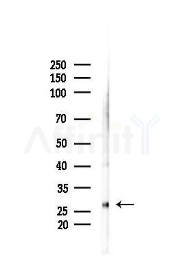 LAT Antibody - Western blot analysis of lysates from A375 cells(heat-shock,45min treatment), using LAT Antibody at 1/1000 dilution.