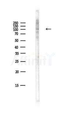 NEDD4L Antibody - Western blot analysis of lysates from HepG2 cells(LPS,4h treatment), using NEDD4L Antibody at 1/1000 dilution.