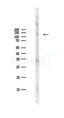 NEDD4L Antibody - Western blot analysis of lysates from PC12 cells(LPS,4h treatment), using NEDD4L Antibody at 1/1000 dilution.