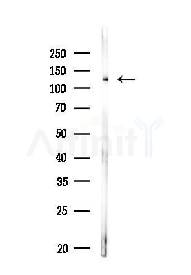 p130 Cas Antibody - Western blot analysis of lysates from MDA-MB-231 cells, using p130 Cas Antibody at 1/1000 dilution.