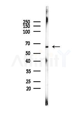 PAK1 /PAK2 Antibody - Western blot analysis of lysates from PC12 cells, using PAK1 /PAK2 Antibody at 1/1000 dilution.