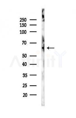 PLK1 Antibody - Western blot analysis of lysates from Mouse brain, using PLK1 Antibody at 1/1000 dilution.