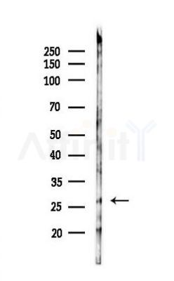 Rac1 Antibody - Western blot analysis of lysates from Mouse brain, using Rac1 Antibody at 1/1000 dilution.