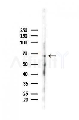 Tau Antibody - Western blot analysis of lysates from A375 cells(heat-shock,45min treatment), using Tau Antibody at 1/1000 dilution.