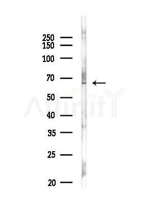 Tau Antibody - Western blot analysis of lysates from MDA-MB-231 cells, using Tau Antibody at 1/1000 dilution.