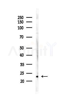 TCTP Antibody - Western blot analysis of lysates from Mouse brain, using TCTP Antibody at 1/1000 dilution.