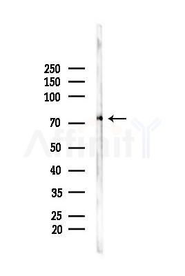 TNK1 Antibody - Western blot analysis of lysates from A375 cells(heat-shock,45min treatment), using TNK1 Antibody at 1/1000 dilution.