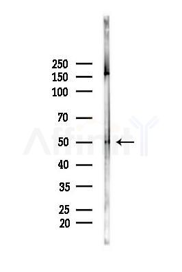KLF4 Antibody - Western blot analysis of lysates from A375 cells(heat-shock,45min treatment), using KLF4 Antibody at 1/1000 dilution.