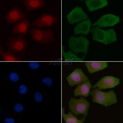 Phospho-Chk1 (Ser296) Antibody - AF3004 staining Hela cells by IF/ICC.