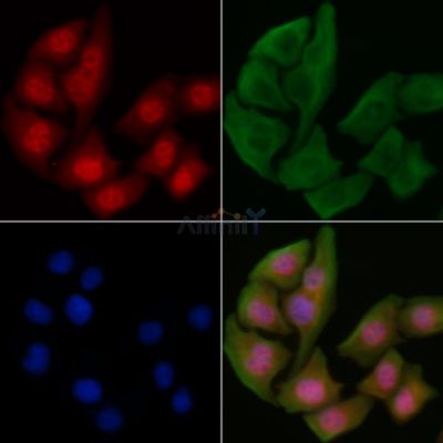 Phospho-IKK alpha/ beta (Ser180/Ser181) Antibody - AF3013 staining Hela cells by IF/ICC.