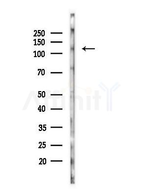 Phospho-JAK2 (Tyr1007) Antibody - Western blot analysis of lysates from Mouse brain, using Phospho-JAK2 (Tyr1007) Antibody at 1/1000 dilution.