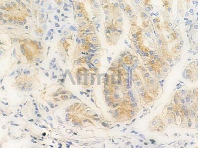 Phospho-JAK2 (Tyr221) Antibody - AF3023 at 1/100 staining human normal gastric tissue by IHC-P.