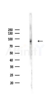 Phospho-p95/NBS1 (Ser343) Antibody - Western blot analysis of lysates from PC12 cells(UV,30min treatment), using Phospho-p95/NBS1 (Ser343) Antibody at 1/1000 dilution.