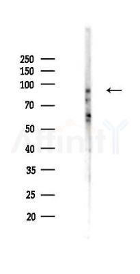 Phospho-p95/NBS1 (Ser343) Antibody - Western blot analysis of lysates from K562 cells(heat-shock,45min treatment), using Phospho-p95/NBS1 (Ser343) Antibody at 1/1000 dilution.