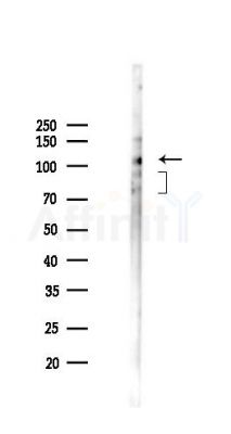 Phospho-Dab1 (Tyr232) Antibody - Western blot analysis of lysates from PC12 cells(UV,30min treatment), using Phospho-Dab1 (Tyr232) Antibody at 1/1000 dilution.