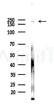 Phospho-c Abl (Tyr245)[Tyr226] Antibody - Western blot analysis of lysates from K562 cells(UV, 30min treatment), using Phospho-c Abl (Tyr245)[Tyr226] Antibody at 1/1000 dilution.