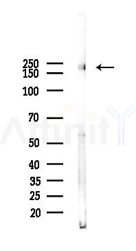 Phospho-ABL1(Tyr393)/ABL2(Tyr439) Antibody - Western blot analysis of lysates from HUVEC cells(UV, 30min treatment), using Phospho-ABL1(Tyr393)/ABL2(Tyr439) Antibody at 1/1000 dilution.