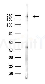 Phospho-ABL1(Tyr393)/ABL2(Tyr439) Antibody - Western blot analysis of lysates from K562 cells(UV, 30min treatment), using Phospho-ABL1(Tyr393)/ABL2(Tyr439) Antibody at 1/1000 dilution.