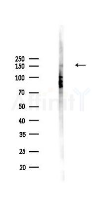 Phospho-EGFR (Thr669)[Tyr693] Antibody - Western blot analysis of lysates from PC12 cells(UV,30min treatment), using Phospho-EGFR (Thr669)[Tyr693] Antibody at 1/1000 dilution.