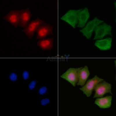 Phospho-EGFR (Ser1070) Antibody - AF3044 staining Hela cells by IF/ICC.
