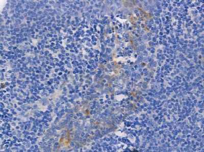 Phospho-EGFR (Tyr1068)[Tyr1092] Antibody - AF3045 at 1/100 staining human normal tonsil tissue by IHC-P.