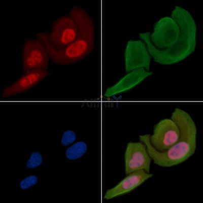 Phospho-EGFR (Ser695) Antibody - AF3050 staining Hela cells(30min of UV treatment) by IF/ICC.
