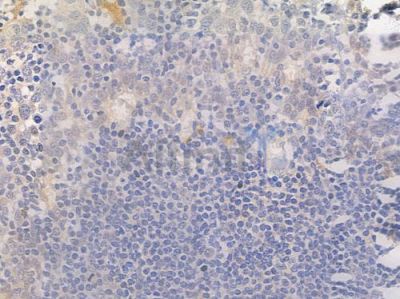 Phospho-Estrogen Receptor alpha (Ser104) Antibody - AF3059 at 1/100 staining human normal tonsil tissue by IHC-P.