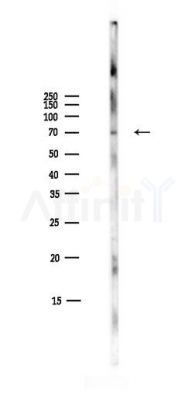 Phospho-C-RAF (Ser259) Antibody - Western blot analysis of lysates from Mouse liver, using Phospho-C-RAF (Ser259) Antibody at 1/1000 dilution.